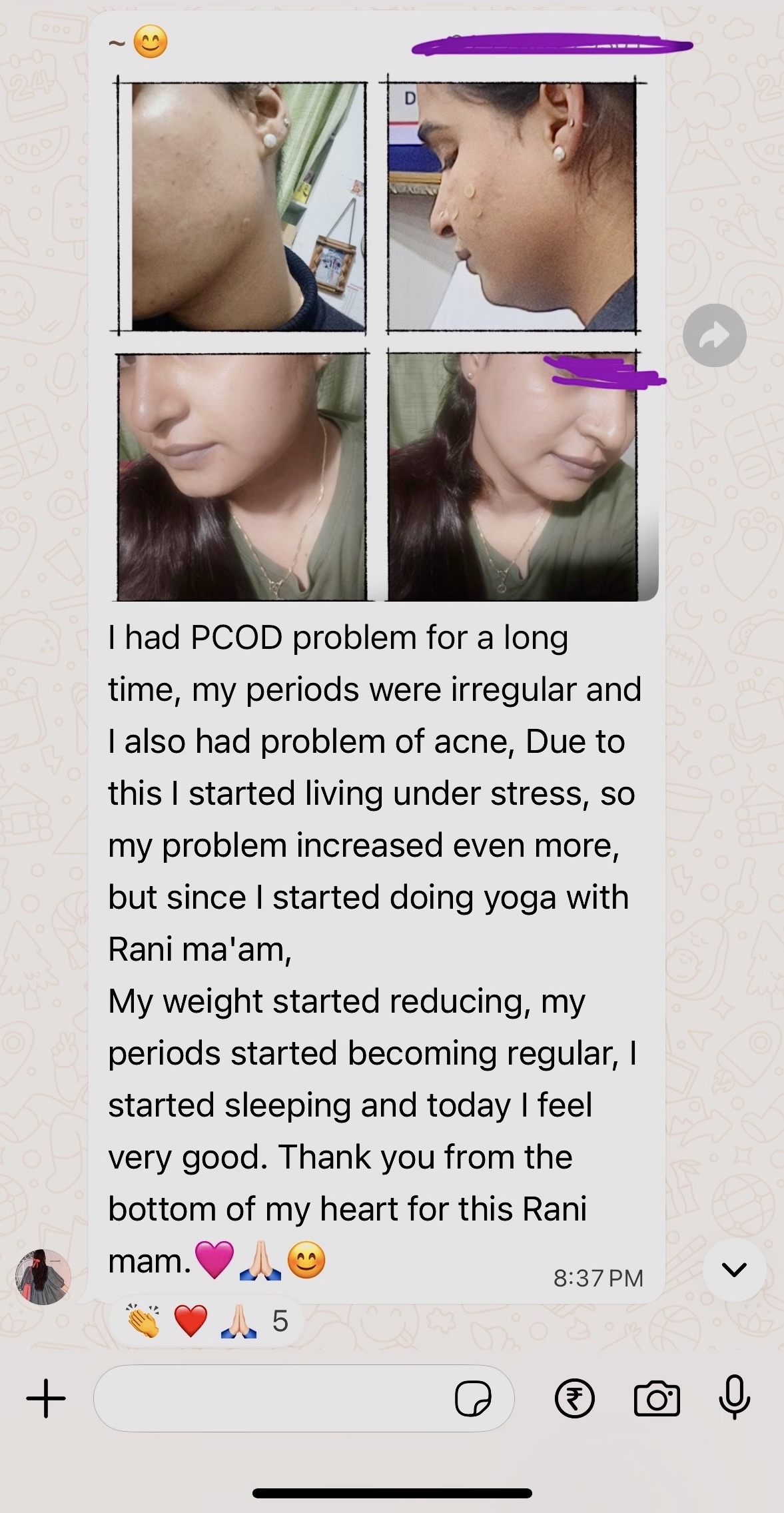 WhatsApp testimonial with before/after photos showing skin improvement